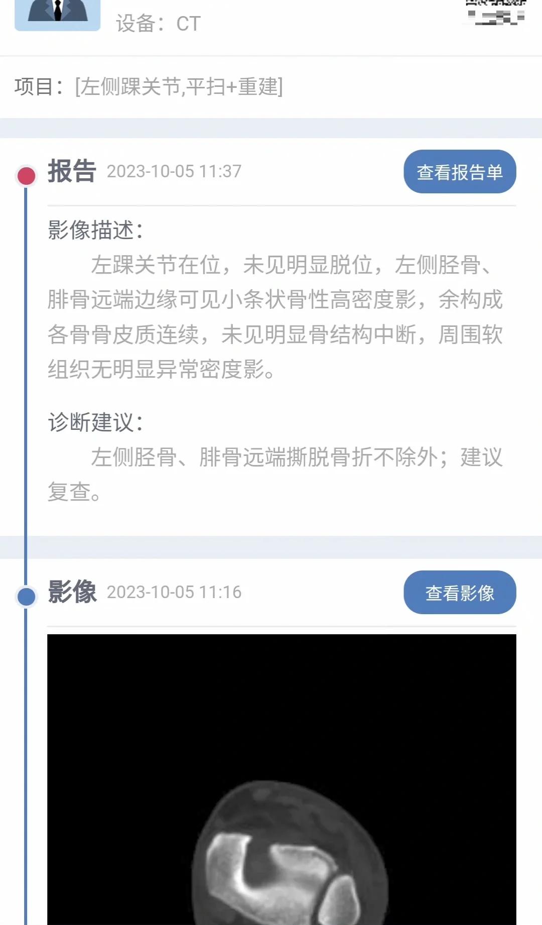 od体育app-穆西亚拉腓骨骨折+韧带受伤预计伤缺4-5月的简单介绍